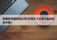 郭婉区块链科技公司[手臂长了红色凸起的红包不痒]